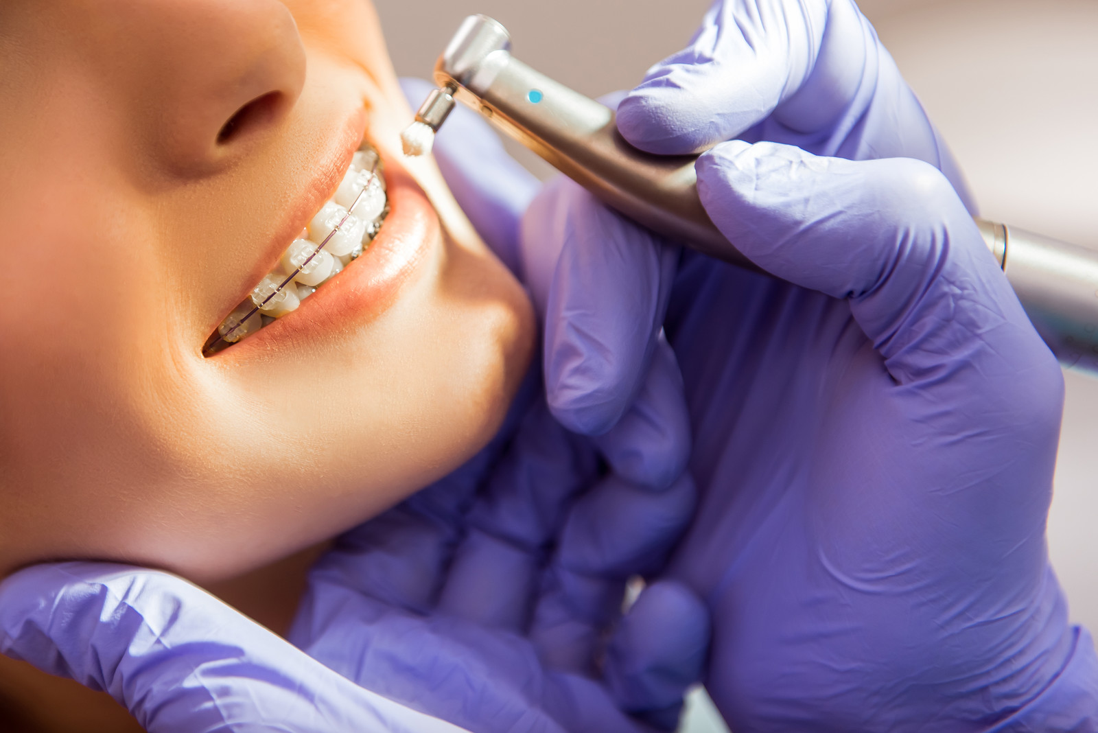 orthodontist in ramona gardens
